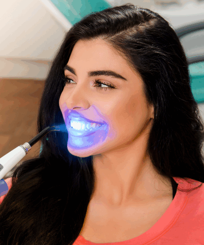 teeth-whitening-westminster